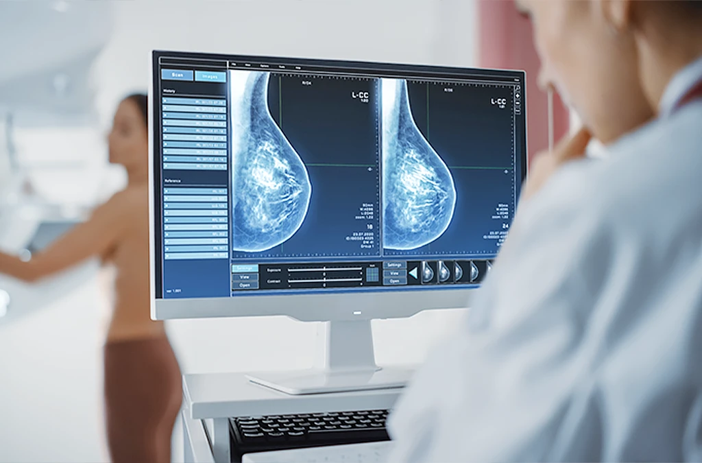 a healthcare worker is looking at a mammography screen, while the patient stands at the device for it.
