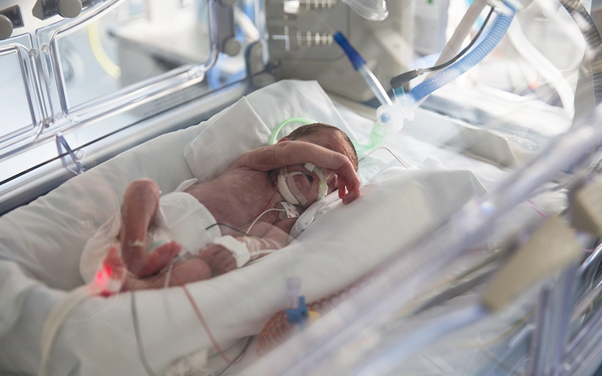 In der neonatologischen Intensivmedizin setzen wir diesen Anspruch um, indem wir bahnbrechende Forschung für die schutzbedürftigste aller Patientengruppen unterstützen: extrem frühgeborene Säuglinge (Foto)